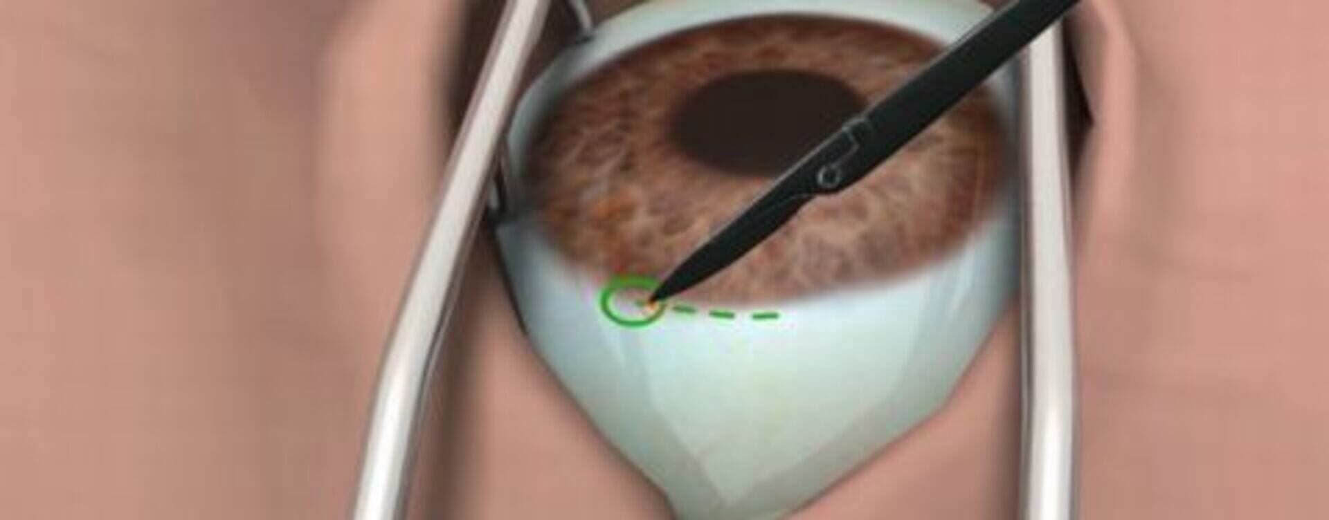 Surgery Simulator screenshot 1